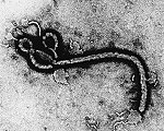 Het ebola-virus